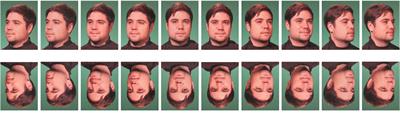 Neural Correlates of Own- and Other-Face Perception in Body Dysmorphic Disorder